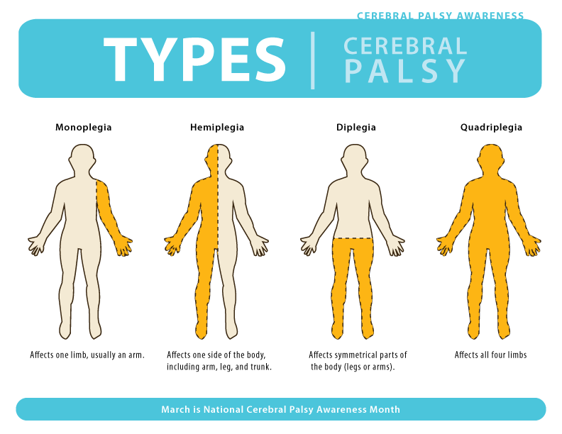 Cerebral Palsy and Parenting